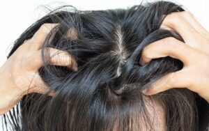 alergia no couro cabeludo