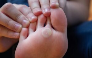 o que é olho de peixe